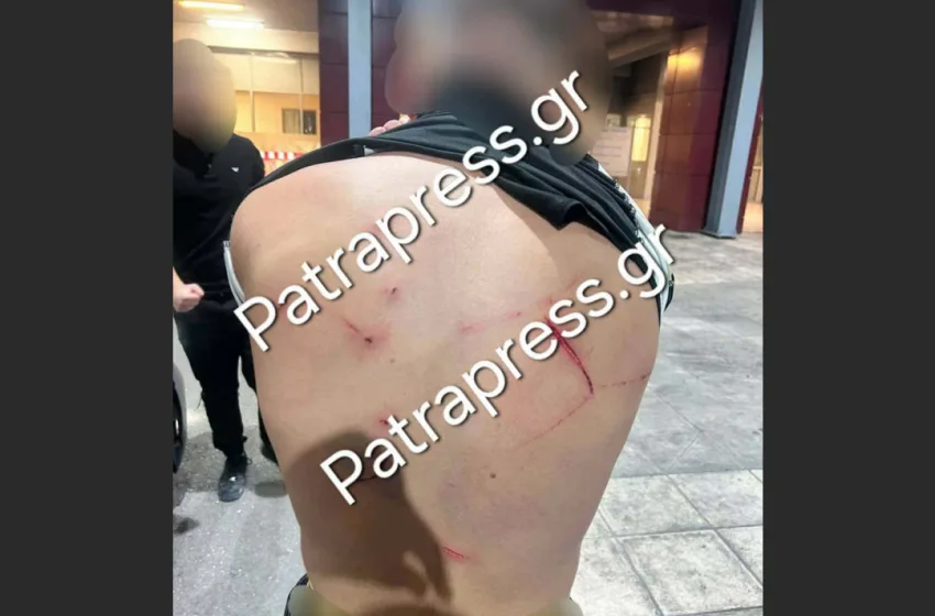  Άγριο σκηνικό στο Ρίο: Χτύπησαν 18χρονο με κατσαβίδι 13 φορές